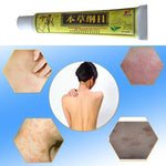 Advanced Psoriasis & Eczema Natural Chinese Herbal Cream